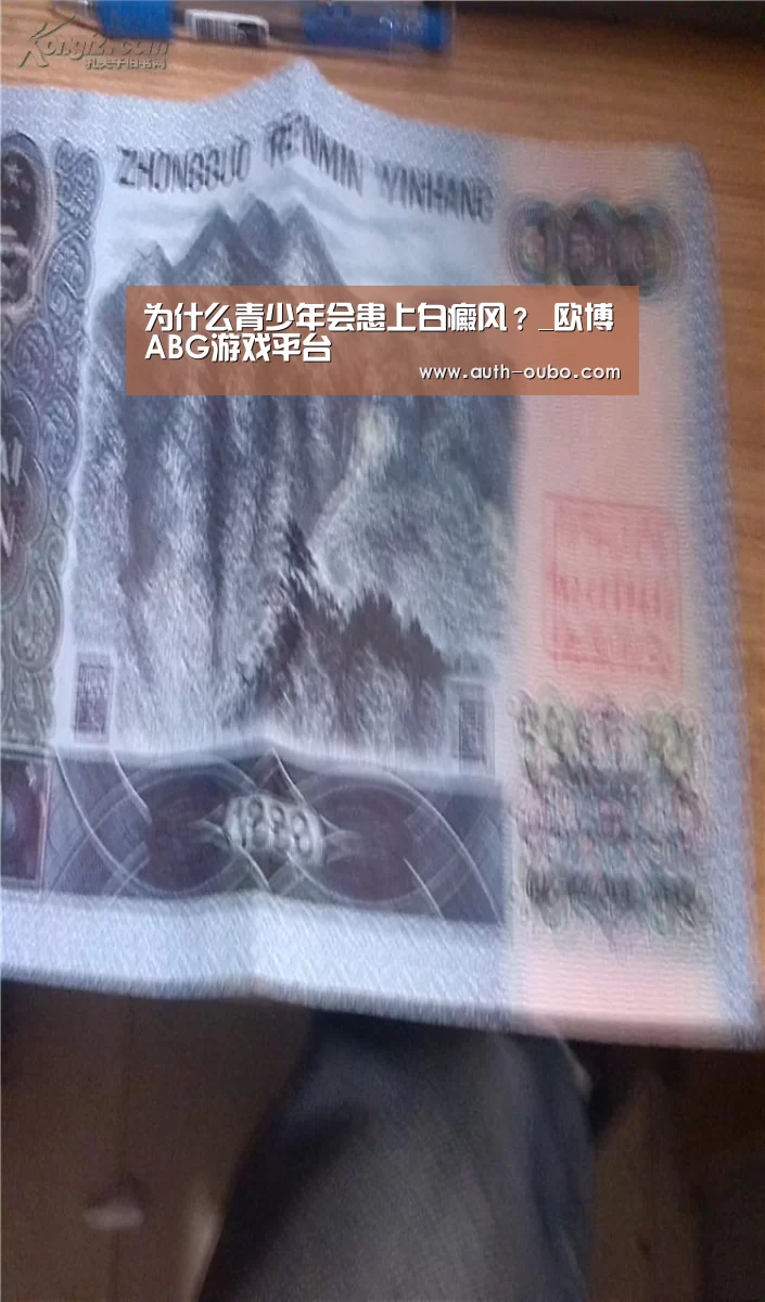 为什么青少年会患上白癜风?_欧博ABG游戏平台(图3) 欧博ABG官网