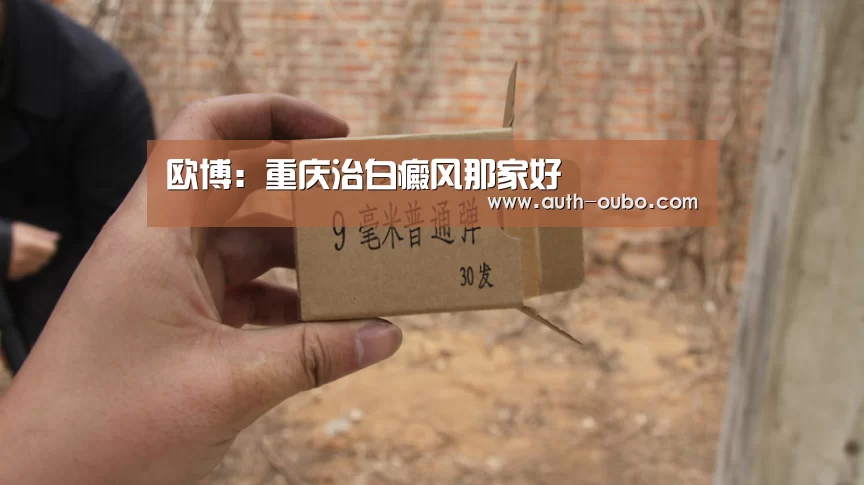 欧博:重庆治白癜风那家好(图3) 欧博ABG游戏平台